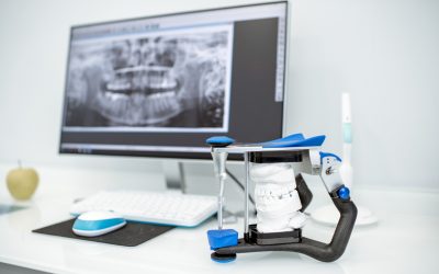 La Nuova Era della Diagnostica Dentale: Scanner Intraorali all’Avanguardia
