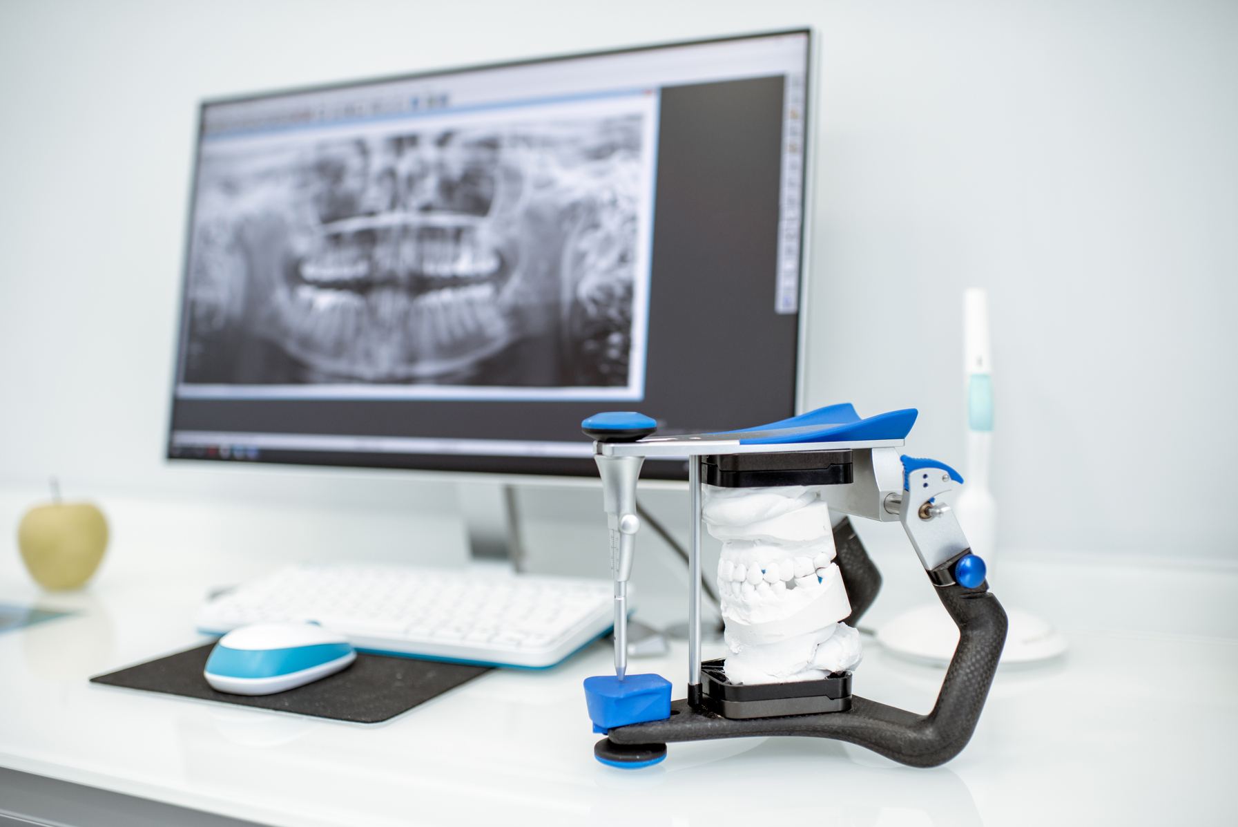 La Nuova Era della Diagnostica Dentale: Scanner Intraorali all'Avanguardia 