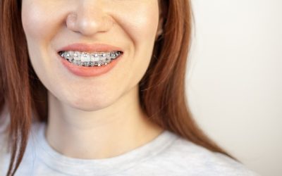 Trattamento delle malocclusioni: dall’analisi ortodontica alle terapie di riequilibrio