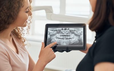 Radiografia digitale in odontoiatria: diagnosi precise per trattamenti mirati