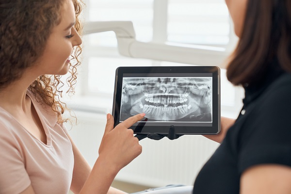 Professionisti valutano una radiografia digitale odontoiatria.